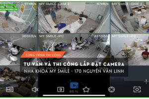 tron-bo-07-camera-ip-nha-khoa-my-smile-170-nguyen-van-linh-1